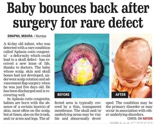 Infant-with-rare-skull-defect-9