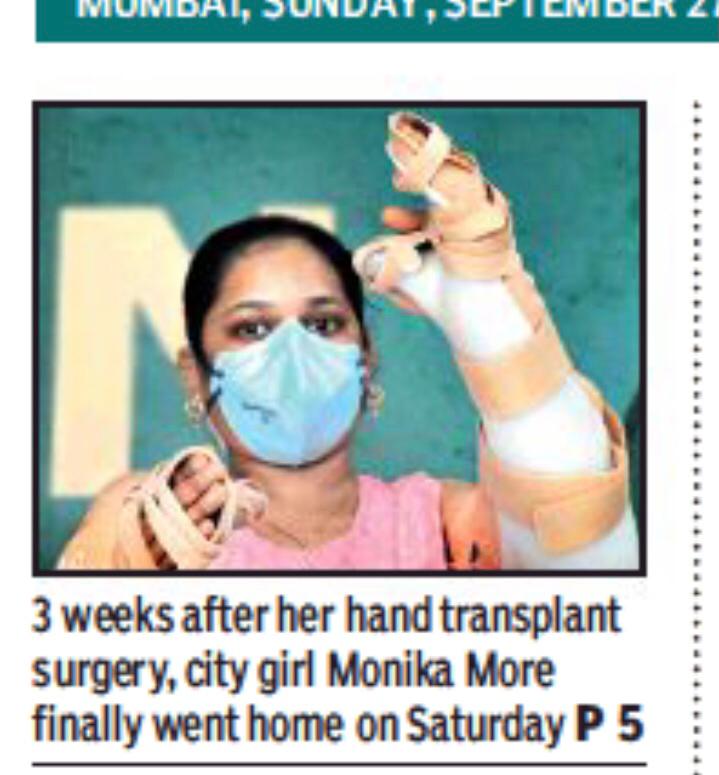 Monika More Hand Transplant-11