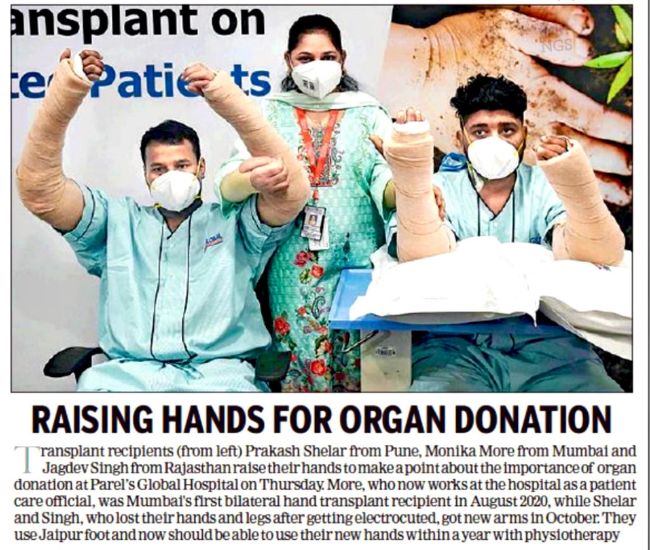 Prakash Shelar Hand Transplant-10