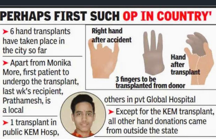 Prathamesh-Tawade-Hand-Transplant-5
